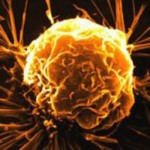 Скачать Учёные обнаружили молекулы, предотвращающие развитие рака