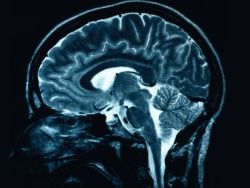 Скачать Ученые: человеческий мозг больше не способен развиваться
