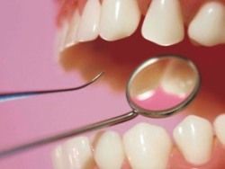 Скачать Плохие зубы могут быть признаком психического недуга
